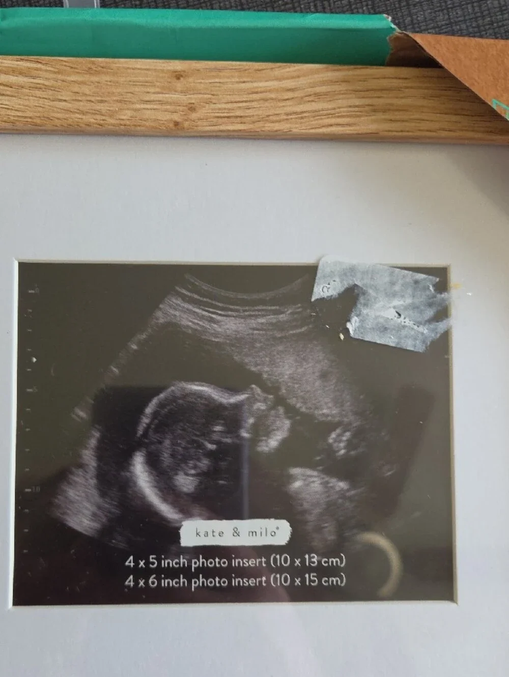 Baby Sonogram And Bracelet Picture Frame